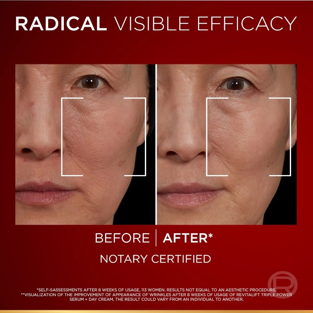 L'oreal Paris Revitalift Laser Triple Power Serum 30ml - Image 3
