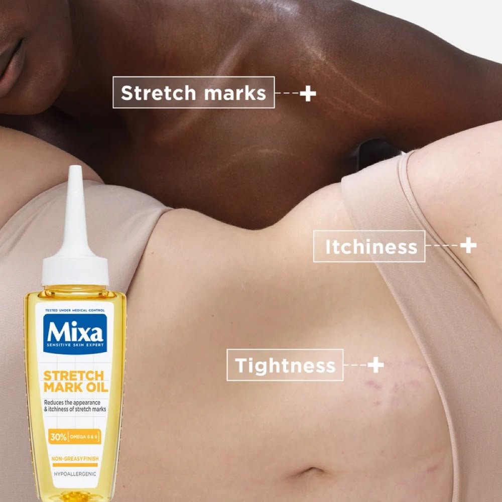 Mixa Anti Stretch Mark Oil With Omega 6 & 9