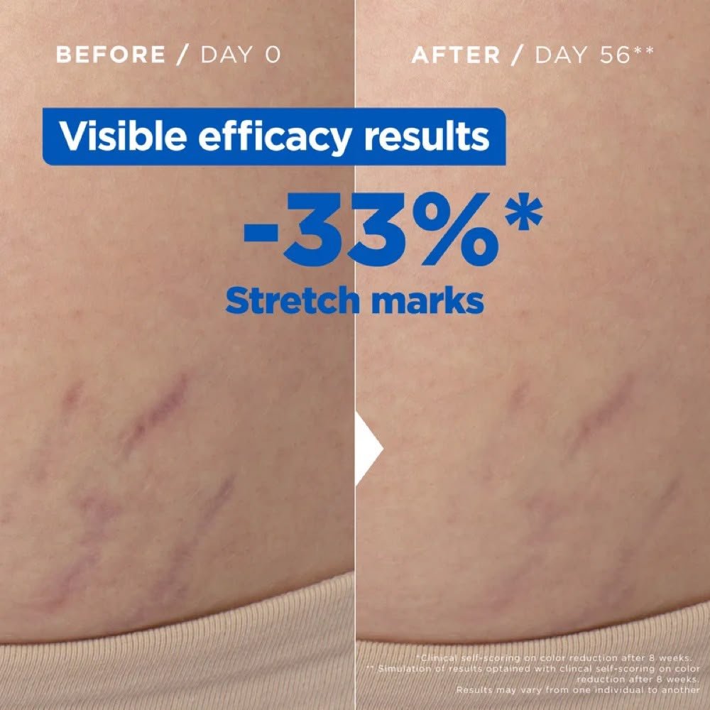 Mixa Anti Stretch Mark Oil With Omega 6 & 9